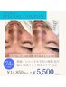 メンズ人気No.1☆【毛穴・ザラつき・くすみなど】ヒト幹肌質改善45分¥5,500