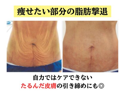 セレブリボーン 大阪ボーテの写真