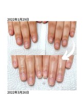 ゴッダスネイル(GODDESS NAIL)/地爪育成