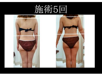 モミ(MOMI)/30代女性