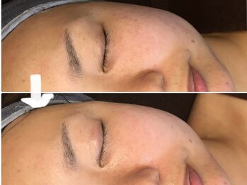 ミロク(369)/くすみクリアに!