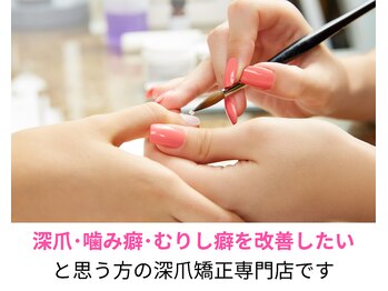 トイロ(toiro)/長年の深爪を卒業