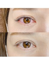 アイラッシュサロン キー(Eyelash salon KEY)/ボリュームラッシュ100束