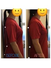 蕨整体院/ダイエットの前に骨盤矯正！