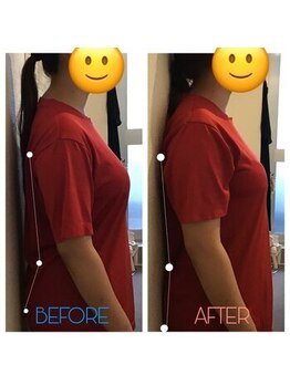 蕨整体院/ダイエットの前に骨盤矯正!