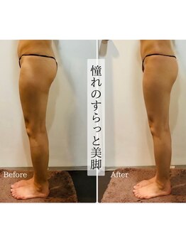 セブンスタイルイ 石巻店(7style)/【お客様ビフォーアフター】