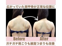 スワン 新栄店(SWAN)/酷い巻き肩もここまで改善★