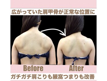 スワン 新栄店(SWAN)/酷い巻き肩もここまで改善★