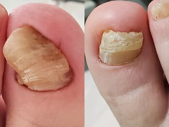 セイラ(Seila)の写真/足・爪のケアやお悩みはプロにおまかせ♪足トラブルを根本から改善する『ドイツ式フットケア』をご提供☆