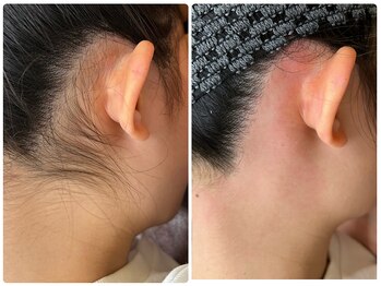 サロンエム 西荻窪(salon M)/うなじワックス