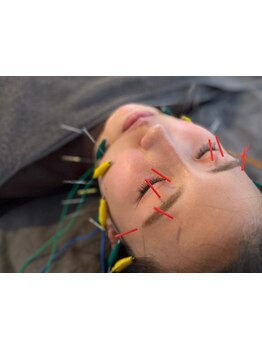 小顔になりたい