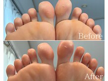 カシェット 広島店(Cachette)/30代女性☆足裏角質ケア90分