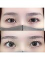 ミウ ネイル(miu nail) ラッシュリフトのbefore→afterです*ぱっちり目力アップ