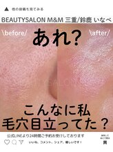 エムアンドエム(M&M)/