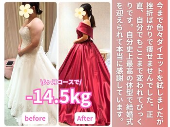 整体院 優(YU)/<20代　ブライダル　ダイエット>