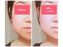 ルミアロマ(RumiAroma)の雰囲気(月1ケアでスッキリした輪郭をキープ!)