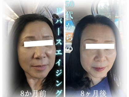 シャイネル(SHYNELL)の写真