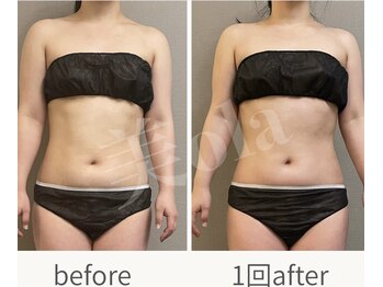 ビオラ(美ola)/姿勢が整うとシルエットも変わる