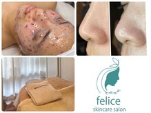 フェリーチェ(felice)