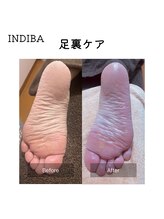 ヒール(heal)/インディバ　下半身60分