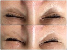 ミロク(369)/Before＆After　プラズマ