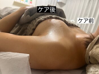 美 プラス(美 Plus)/【左右差のお悩み】