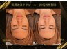 【毛穴改善】韓国で話題の水光肌！ピーリングララピール¥14,500