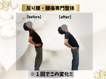 エモシオン トウキョウ(EMOTION TOKYO)/反り腰・腰痛専門整体