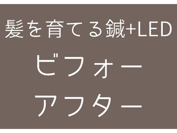 やなけん 亀戸店/髪質改善/小顔/育毛促進