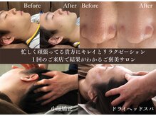 頭のオアシすぱ