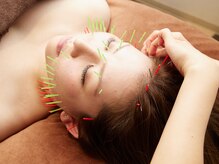 ルディア 堂島店(ledia)/大阪・美容鍼ledia（ルディア）