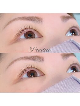 ピュアリス(Pualice)/ラッシュリフト