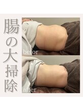 フラットベリー 恵比寿(Flat BELLY)/腸セラピー90分/1回