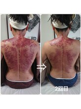 オアシス(OASIS)/ホット★カッサ