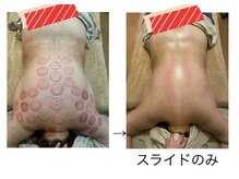 プルフローラ(pluflora)/状態や目的に合わせたカッピング