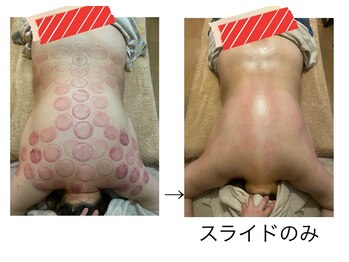 プルフローラ(pluflora)/状態や目的に合わせたカッピング