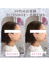 ラ セラフィータ 中目黒/【上級小顔】EMS美容液導入付き