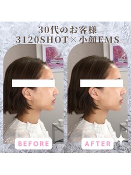 ラ セラフィータ 中目黒/【上級小顔】EMS美容液導入付き