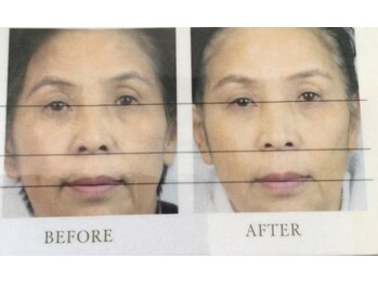 レオティアラ(REOTIARA)/20代から60代の方もご来店です