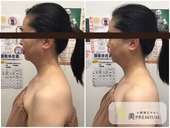 美プレミアム 越谷店/360°美顔小顔矯正｜施術結果