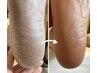 【踵の角質ケア】(フットネイルとセット)フットバス、パック付