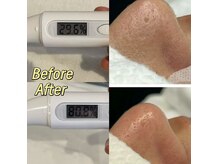 リピート率9割超！当店自慢の毛穴、保湿、美白ケアで陶肌へ！