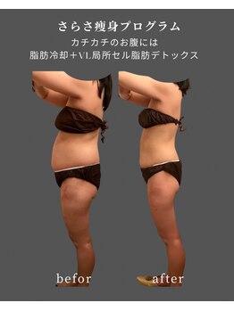 ナチュラル ビューティー スタイル さらさ(Natural Beauty Style)/カチカチの腹部に最適なのは