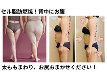 ヨサパーク ラ エトワール 広畑店(YOSAPARK)