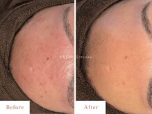 ベル 戸塚(Belle)の雰囲気（【お得な回数券あり】継続していただくほど根本肌質改善へ＊）