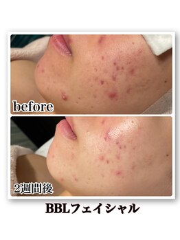 ルアナライフ(Luana Life)の写真/今あるシミシワも、これからの老け見えも同時ケア