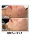 ルアナライフ(Luana Life)の写真/今あるシミシワも、これからの老け見えも同時ケア
