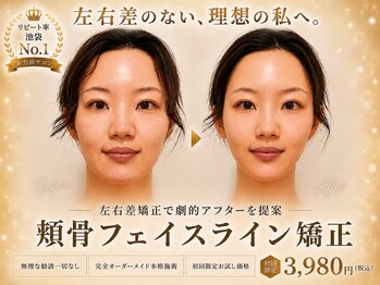 モアフェイス 池袋店(More Face)の写真/◆頬骨矯正＋脂肪矯正が大得意◆頭蓋骨から小顔に！施術に自信あり【ゆがみ矯正・リンパ矯正3980円~】