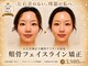 モアフェイス 池袋店(More Face)の写真/◆頬骨矯正＋脂肪矯正が大得意◆頭蓋骨から小顔に！施術に自信あり【ゆがみ矯正・リンパ矯正3980円~】