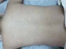 ナノハナ/鹿沼市全身脱毛美容室ナノハナ